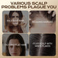 Herbal Hair Loss Prevention and Hair Growth Shampoo